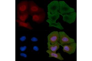 ABIN6259872 and ABIN6266829 staining Hela cells(30 min of UV treatment) by IF/ICC. (Cyclin-Dependent Kinase 15 (ALS2CR7) (Internal Region) anticorps)