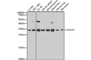 Western blot analysis of extracts of various cell lines, using CLEC7A antibody. (CLEC7A anticorps)