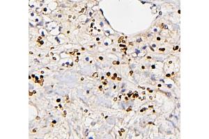 IHC analysis of FOSB using anti-FOSB antibody (ABIN3042399).