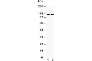 Western blot testing of ATP2A2 antibody and Lane 1:  rat skeletal muscle;  2: mouse skeletal muscle;  Predicted size: 115KD;  Observed size: 115KD (ATP2A2 anticorps  (N-Term))