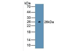 WB of Protein Standard: different control antibodies against Highly purified E.