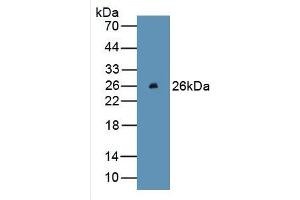 WB of Protein Standard: different control antibodies against Highly purified E. (Bcl-2 Kit ELISA)