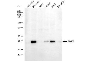 Western blotting analysis using TIMP2 antibody (ABIN7799377).