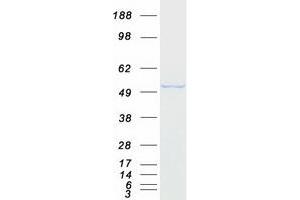 Validation with Western Blot