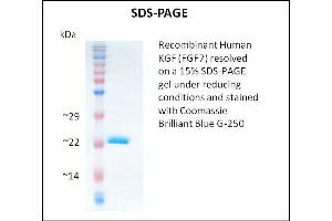 SDS-PAGE (SDS) image for Fibroblast Growth Factor 7 (FGF7) (Active) protein (ABIN5509361) (FGF7 Protéine)