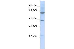 SLC35F3 antibody used at 1 ug/ml to detect target protein.