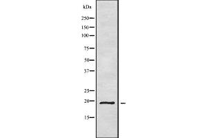 Western blot analysis of CD164L2 using HepG2 whole cell lysates (CD164L2 anticorps)