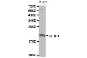 Western Blotting (WB) image for anti-Killer Cell Lectin-Like Receptor Subfamily D, Member 1 (KLRD1) antibody (ABIN1873452) (CD94 anticorps)