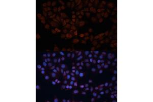 Immunofluorescence analysis of HeLa cells using TOM70 antibody (ABIN1683089, ABIN3018839, ABIN3018840 and ABIN6220597) at dilution of 1:100.