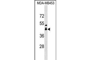 ALX1 Antibody (Center) (ABIN1538707 and ABIN2849356) western blot analysis in MDA-M cell line lysates (35 μg/lane). (ALX1 anticorps  (AA 97-122))