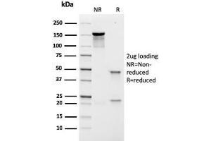 SDS-PAGE Analysis Purified Prolactin Receptor Recombinant Mouse Monoclonal (rPRLR742). (Recombinant Prolactin Receptor anticorps)
