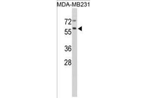 Image no. 1 for anti-Cathepsin F (CTSF) (Middle Region) antibody (ABIN452888)