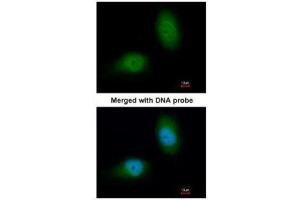 ICC/IF Image Immunofluorescence analysis of paraformaldehyde-fixed HeLa, using HSPB8, antibody at 1:200 dilution.