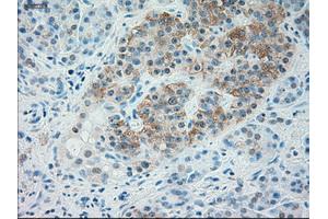 Immunohistochemical staining of paraffin-embedded liver tissue using anti-TRPM4mouse monoclonal antibody. (TRPM4 anticorps)