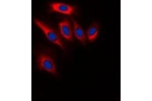 Immunofluorescent analysis of PTEN staining in Hela cells. (PTEN anticorps  (C-Term))