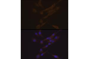 Immunofluorescence analysis of THP-1 and K562 cells using YKL-40/CHI3L1 Rabbit mAb (ABIN7266328) at dilution of 1:100 (40x lens). (CHI3L1 anticorps)