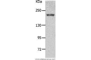 Western blot analysis of Mouse kidney tissue, using NPHS1 Polyclonal Antibody at dilution of 1:700 (Nephrin anticorps)