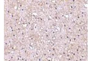 Immunohistochemistry of CTRP5 in human brain tissue with CTRP5 antibody at 10 μg/ml.