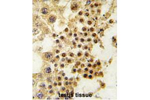 Formalin-fixed and paraffin-embedded human testis tissue reacted with GDF3 polyclonal antibody  , which was peroxidase-conjugated to the secondary antibody, followed by DAB staining. (GDF3 anticorps  (Internal Region))