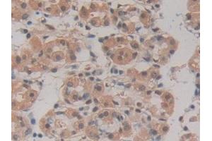 Detection of HSPA1A in Human Stomach Tissue using Polyclonal Antibody to Heat Shock 70 kDa Protein 1A (HSPA1A)