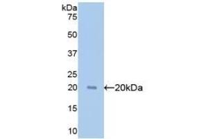 Detection of Recombinant GPC1, Human using Polyclonal Antibody to Glypican 1 (GPC1) (GPC1 anticorps  (AA 114-277))
