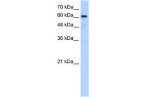Western Blotting (WB) image for anti-ADAM Metallopeptidase Domain 30 (ADAM30) antibody (ABIN2463285)