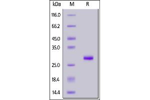 Rabbit IgG Fc, Tag Free on  under reducing (R) condition. (IgG Fc (AA 105-323) (Active) Protéine)