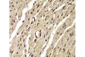 Immunohistochemistry of paraffin-embedded Human colon using PSMB8 Polyclonal Antibody at dilution of 1:100 (40x lens). (PSMB8 anticorps)