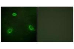 Immunofluorescence analysis of HepG2 cells, using TM16G antibody. (Anoctamin 7 anticorps  (C-Term))
