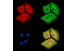 ABIN6265341 and ABIN6279794 staining Hela cells by IF/ICC.