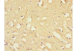 Immunohistochemistry of paraffin-embedded human brain tissue using ABIN7152410 at dilution of 1:100 (FBXO2 anticorps  (AA 1-296))