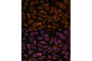 Immunofluorescence analysis of L929 cells using RABIF Polyclonal Antibody (ABIN7269786) at dilution of 1:100 (40x lens).