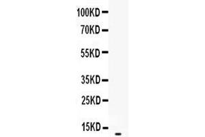 Western blot analysis of CXCL2 expression in recombinant human CXCL2 protein 0. (CXCL2 anticorps  (AA 39-107))