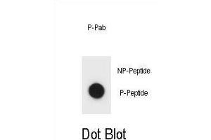 Dot blot analysis of IKKB Antibody (Phospho ) Phospho-specific Pab (ABIN1881450 and ABIN2850469) on nitrocellulose membrane. (IKBKB anticorps  (pSer177))
