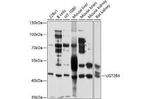 Western blot analysis of extracts of various cell lines, using UGT2B4 antibody (ABIN1683211, ABIN3018660, ABIN3018661 and ABIN6220530) at 1:1000 dilution. (UGT2B4 anticorps  (AA 280-480))