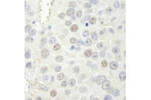 Immunohistochemistry (IHC) image for anti-RNA polymerase-associated protein RTF1 homolog (RTF1) (C-Term) antibody (ABIN7449019) (RTF1 anticorps  (C-Term))