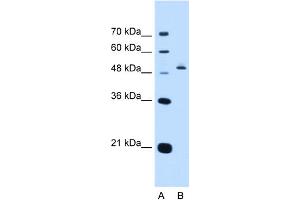 WB Suggested Anti-PAX8 Antibody Titration:  0. (PAX8 anticorps  (N-Term))