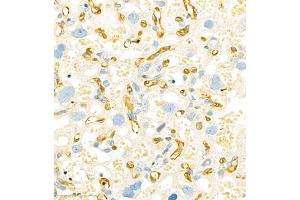 Immunohistochemistry analysis of paraffin embedded rat plancta using HOMER3 (ABIN7074257) at dilution of 1: 2100