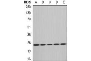 Western blot analysis of MsrA expression in HT29 (A), Hela (B), mouse heart (C), rat kidney (D), rat liver (E) whole cell lysates. (MSRA anticorps)