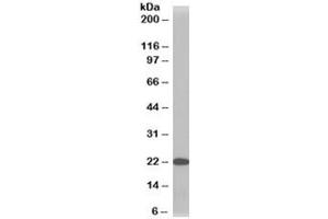 Western blot testing of HeLa lysate with TMS1 antibody at 1ug/ml. (PYCARD anticorps)