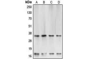 Western blot analysis of Caspase 3 expression in HeLa (A), SP2/0 (B), Raw264. (Caspase 3 anticorps  (Center))