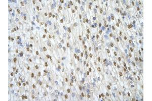 Rabbit Anti-ILF3 antibody   Paraffin Embedded Tissue: Human Heart cell Cellular Data: cardiac cell of renal tubule Antibody Concentration: 4. (Interleukin enhancer-binding factor 3 (ILF3) (N-Term) anticorps)
