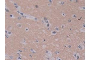 Detection of PEBP1 in Human Cerebrum Tissue using Polyclonal Antibody to Phosphatidylethanolamine Binding Protein 1 (PEBP1) (PEBP1 anticorps  (AA 2-187))