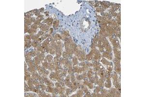 Immunohistochemical staining (Formalin-fixed paraffin-embedded sections) of human liver with CYP4F2 polyclonal antibody  shows moderate cytoplasmic positivity in hepatocytes. (CYP4F2 anticorps)