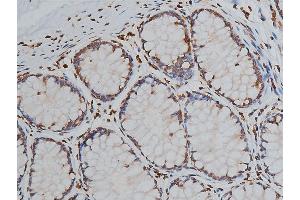 ABIN6267039 at 1/50 staining human colon tissue sections by IHC-P. (Histone 3 anticorps)