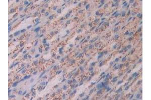 Detection of CTSD in Rat Stomach Tissue using Polyclonal Antibody to Cathepsin D (CTSD) (Cathepsin D anticorps  (AA 120-407))
