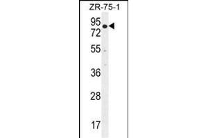 BTRC Antibody (N-term) (ABIN655814 and ABIN2845238) western blot analysis in ZR-75-1 cell line lysates (35 μg/lane). (BTRC anticorps  (N-Term))