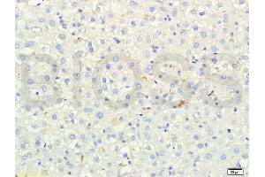 Formalin-fixed and paraffin embedded rat liver tissue labeled with Anti-SREBP-2 Polyclonal Antibody, Unconjugated (ABIN751258) at 1:200 followed by conjugation to the secondary antibody and DAB staining (SREBF2 anticorps)