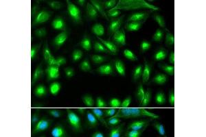 Immunofluorescence analysis of A549 cells using GEMIN2 Polyclonal Antibody (SIP1 anticorps)