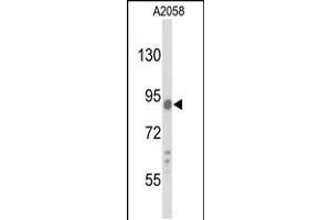 Western blot analysis of COG4 Antibody in A2058 cell line lysates (35ug/lane) (COG4 anticorps  (C-Term))